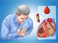 心梗急救要点，紧急情况下可使家人转危为安